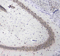 Anti-L1CAM Antibody