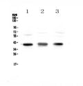 Anti-CCR4 Antibody Picoband®