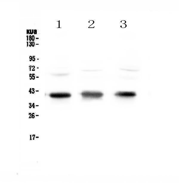 Anti-CCR4 Antibody Picoband®