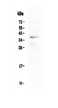 Anti-LOX-1/OLR1 Antibody Picoband®