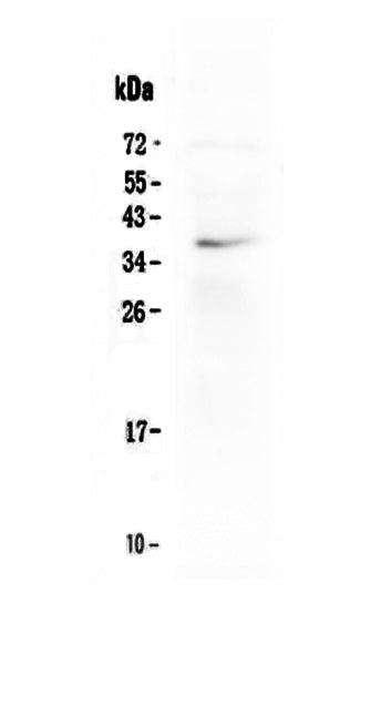 Anti-LOX-1/OLR1 Antibody Picoband®