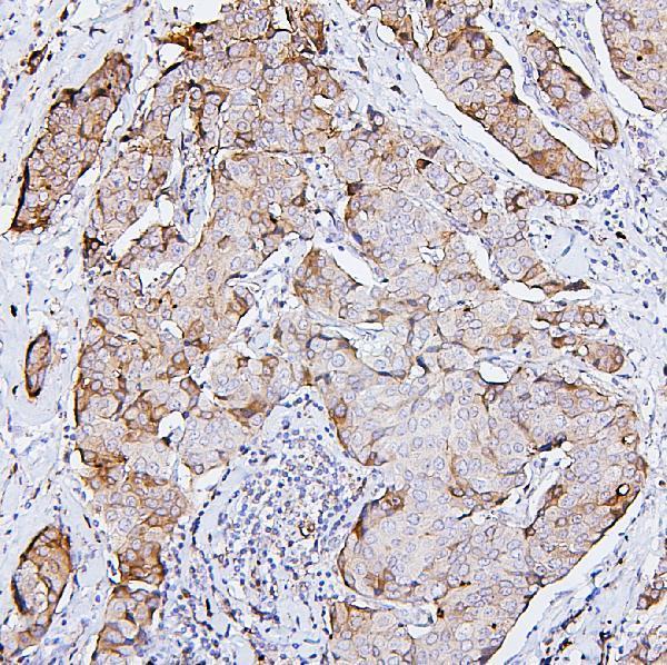 Anti-PKC delta/PRKCD Antibody Picoband®