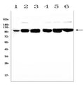 Anti-MCK10/NEP/DDR1 Antibody Picoband®