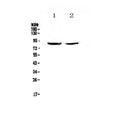 Anti-SLC26A4 Antibody Picoband®