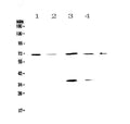 Anti-DNA Polymerase lambda/POLL Antibody Picoband®