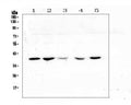 Anti-uPA Receptor/PLAUR Antibody Picoband®