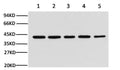 Fig.1. Western blot analysis of hela (1), rat brain (2), Mouse brain (3), chicken lung (4) and rabbit testis (5), diluted at 1:10000.
