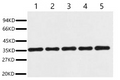 Fig. Western blot analysis of 293T (1), Rat brain (2), NIH 3T3 (3), Sheep Muscle (4), Rabbit testis (5), diluted at 1:20000. Secondary antibody was diluted at 1:20000.