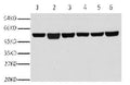 Fig.1. Western blot analysis of A549(1), rat brain (2), mouse brain (3), chicken lung (4) and rabbit testis(5), sheep muscle(6), diluted at 1:10000.