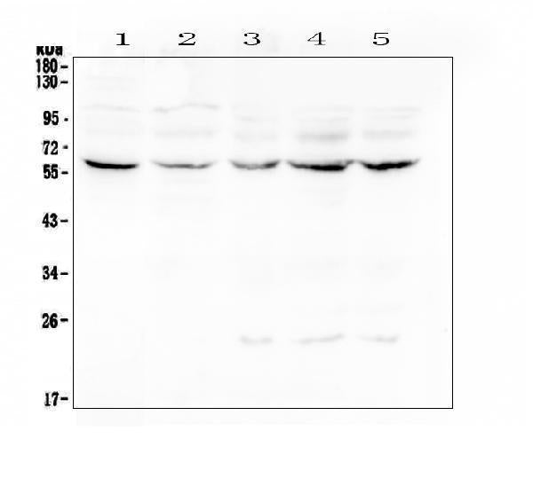 Anti-Lumican Antibody Picoband®