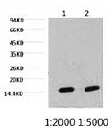 Fig.1. Western blot analysis of Hela, diluted at 1) 1:2000 2) 1:5000.