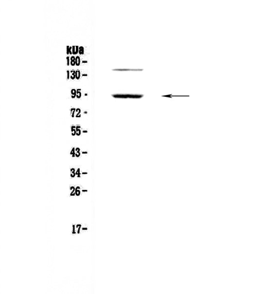 Anti-PDE4D Antibody Picoband®