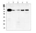 Anti-Cortactin/CTTN Antibody Picoband®