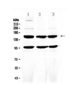 Anti-VEGF Receptor 3/FLT4 Antibody Picoband®