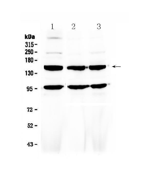 Anti-VEGF Receptor 3/FLT4 Antibody Picoband®