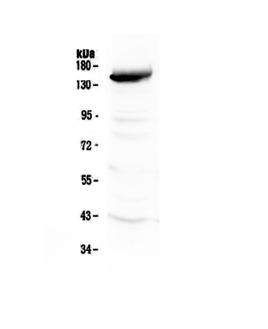 Anti-VEGF Receptor 3/FLT4 Antibody Picoband®