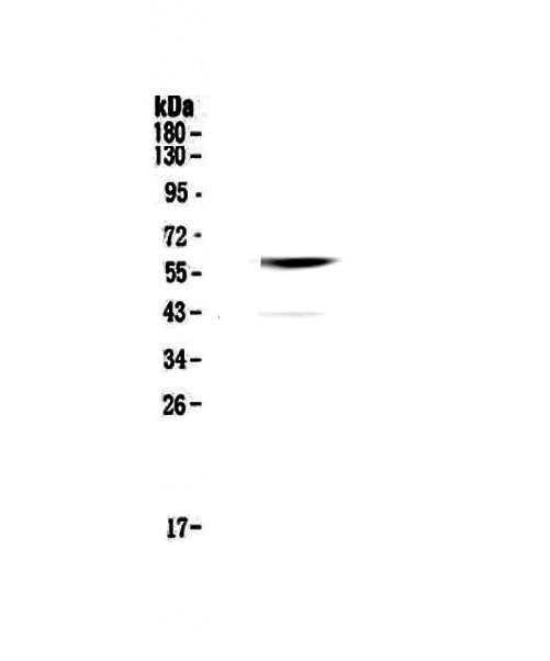 Anti-Cannabinoid Receptor I/CNR1 Antibody Picoband®