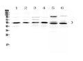 Anti-Retinoid X Receptor alpha/RXRA Antibody Picoband®