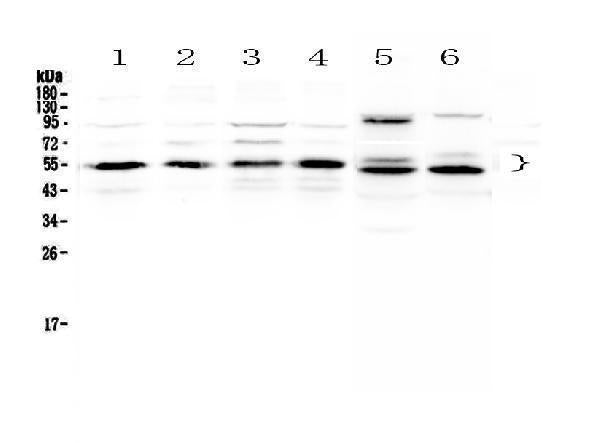 Anti-Retinoid X Receptor alpha/RXRA Antibody Picoband®