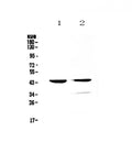 Anti-Cathepsin D/Ctsd Antibody Picoband®