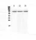 Anti-epithelial Sodium Channel alpha/SCNN1A Antibody Picoband®