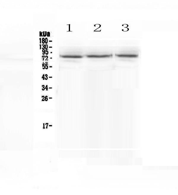 Anti-epithelial Sodium Channel alpha/SCNN1A Antibody Picoband®