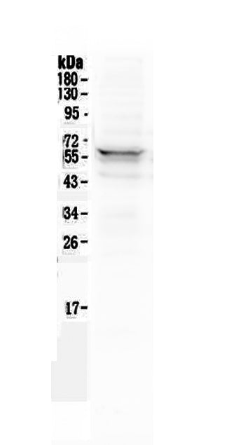 Anti-Lyn Antibody Picoband®