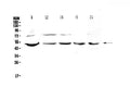 Anti-strogen Related Receptor gamma/ESRRG Antibody Picoband®
