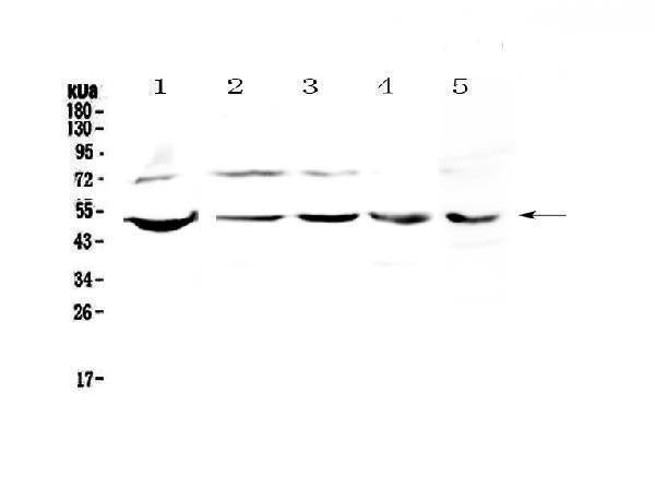Anti-strogen Related Receptor gamma/ESRRG Antibody Picoband®