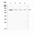 Anti-ABCG8 Antibody Picoband®