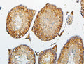 Anti-CRB1 Antibody Picoband®