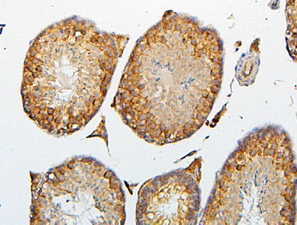 Anti-CRB1 Antibody Picoband®