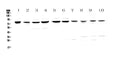 Anti-PARN Antibody Picoband®