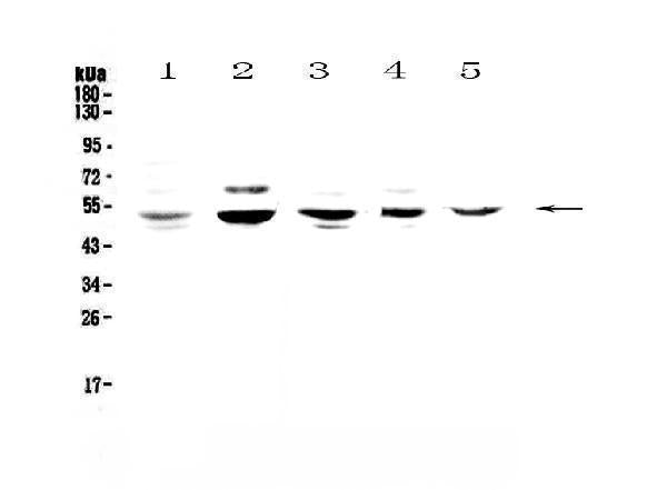 Anti-NFIB/NF1B2 Antibody Picoband®