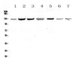 Anti-SMC6L1 Antibody Picoband®