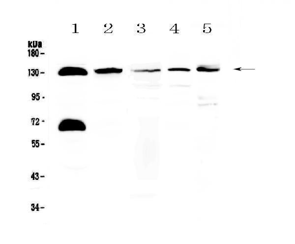 Anti-NEDD4-2/NEDD4L Antibody Picoband®