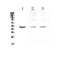 Anti-Tryptophan Hydroxylase/TPH1 Antibody Picoband®