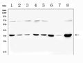 Anti-PITX2/RGS Antibody Picoband®