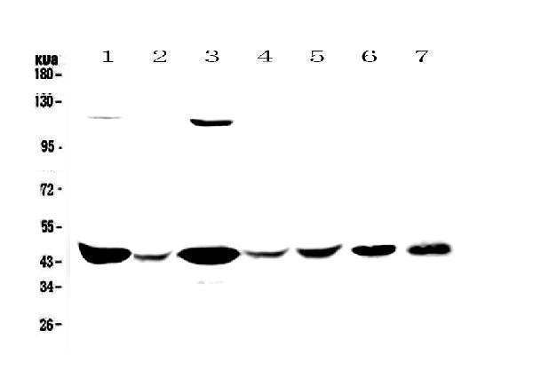 Anti-Creatine kinase B type/CKB Antibody Picoband®