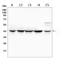 Anti-MEK4/MAP2K4 Antibody Picoband®