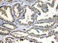 Anti-Superoxide Dismutase 3/SOD3 Antibody Picoband®