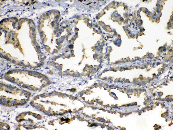 Anti-Superoxide Dismutase 3/SOD3 Antibody Picoband®