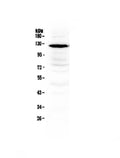 Anti-NMDAR1/GRIN1 Antibody Picoband®