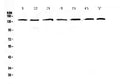 Anti-PERK/EIF2AK3 Antibody Picoband®