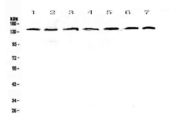 Anti-PERK/EIF2AK3 Antibody Picoband®