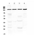 Anti-TRPC4 Antibody Picoband®