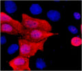 Fig.1. Immunofluorescence staining (1:1500) of His fusion protein in 293 cells with red and counterstained with DAPI.