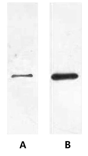 Fig. Western blot analysis of His fusion protein in cell lysate from transfected 293T cells (lane A) and baculovirus expression vector system (lane B) at 1:2000 dilutions.