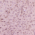 Anti-Calcitonin/Calca Antibody