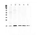 Anti-Psoriasin/S100A7 Antibody Picoband®